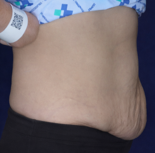 Before/After Image